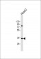 AKR7L Antibody (N-Term)